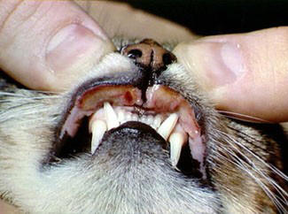 Mouth Ulcers